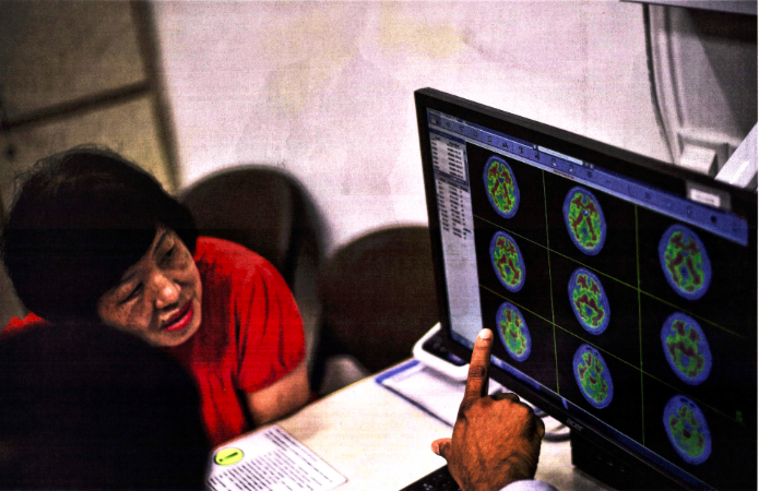  Retiree Margaret Tan was found to have harmful amyloid proteins in her brain, which could be a precursor to Alzheimer's disease. She is taking part in a clinical trial of anti-amyloid drugs, and keeping herself fit, healthy and socially active to stave off dementia, from which her late mother suffered in the last decade of her life.